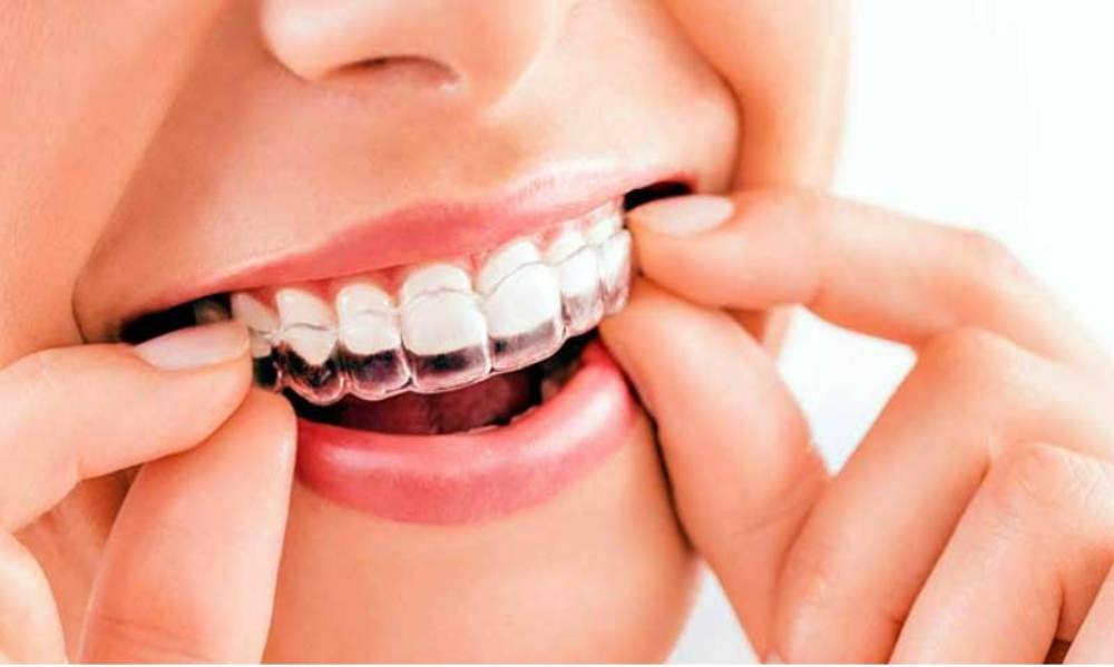 Same Day Dental Implants In Dubai