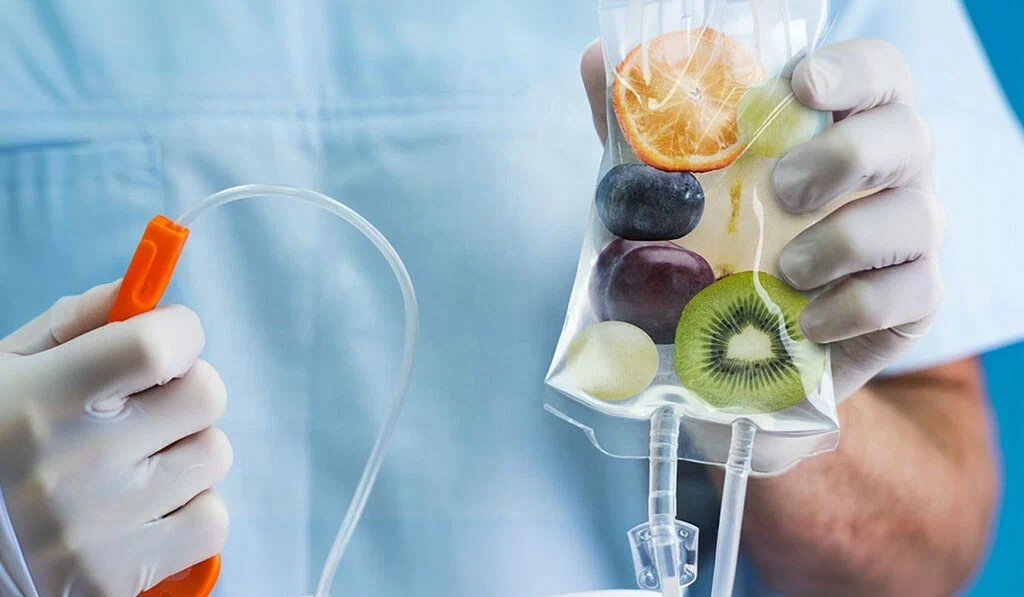 IV Vitamin Therapy